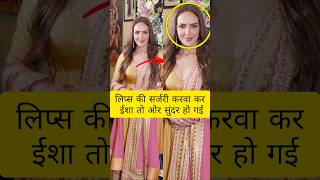 Esha deol looking beautiful after lips surgery shorts eshadeol [upl. by Wordoow]