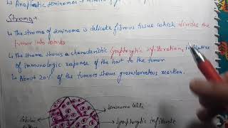 Seminoma Pathology [upl. by Assirt904]