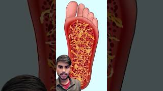 ASMR REMOVE DOG TICKS FROM INJECTED FOOT gameplay rescue asmar [upl. by Ralph]