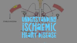 The pathophysiology of ischaemic heart disease [upl. by Dorlisa353]