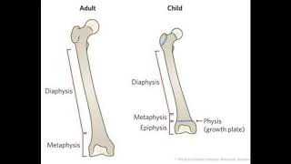 Benign bone tumourosteoma osteoid osteomaosteoblastoma [upl. by Siloum]