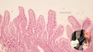 Microscopic anatomy of the small intestine [upl. by Iney]