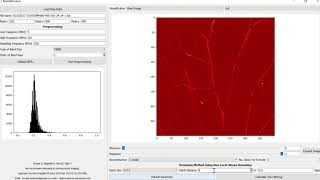 Photoacoustic Imaging  Image Reconstruction [upl. by Connie]