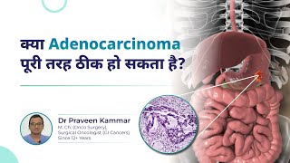 Adenocarcinoma Is a Complete Cure Possible  Cancer QampA  Dr Praveen Kammar Mumbai [upl. by Altaf]