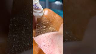 Remove Blackheads Naturally At Home  Get Rid Of Blackheads amp Open Pores youtubeshorts viralvideo [upl. by Antonella]