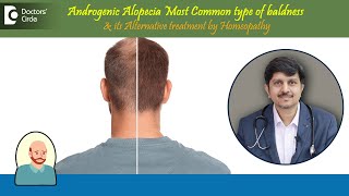 BaldnessAndrogenic AlopeciaAlternative Treatment by Homeopathy DrSanjay PanickerDoctors Circle [upl. by Murrah]