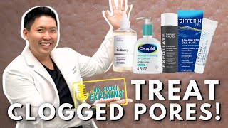 Sneaky Ways to Treat Clogged Pores [upl. by Seto]