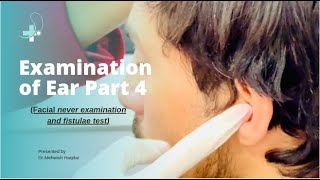 Examination of Ear Part 4  Facial never examination and fistulae test [upl. by Aerdnahc]