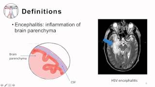 2 Bacterial Meningitis Pathogenesis and Clinical Manifestion [upl. by Nnyladnarb951]