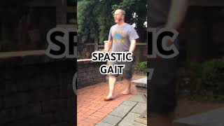 Spastic Gait [upl. by Anaes]