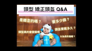 Baby Helmet Therapy Plagiocephaly 嬰兒 矯正頭盔QampA [upl. by Llevel]