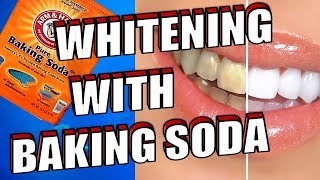 How To Easily WHITEN Your TEETH With BAKING SODA [upl. by Nosinned234]