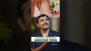 Can Certain Foods REALLY Reduce Varicose Veins [upl. by Fabe906]