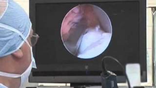 Equine Arthroscopic Surgery [upl. by Lorilee613]