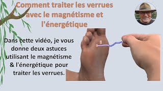 Révolutionnez votre Santé Éliminez les Verrues avec le Magnétisme Humain  Formation magnétiseur [upl. by Volny]