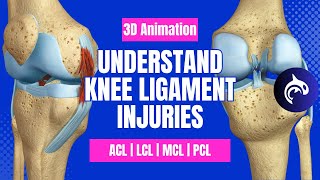 Understand Knee Ligament Injuries ACL PCL MCL LCL  3D animation [upl. by Bork]