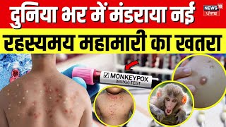 Rajasthan News  दुनिया भर में मंडराया नई रहस्यमय महामारी का खतरा  Mankey Pox  Monkey Pox  WHO [upl. by Odlanor550]