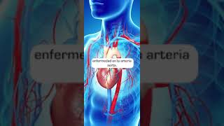 Hablemos de hemodinamia cardiología intervencionista  ¿Qué es [upl. by Oraneg]