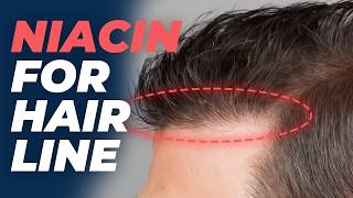 NIACIN for Hair Growth  How Well Does it Work [upl. by Nerwal]