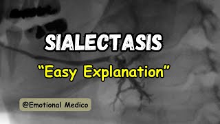 Sialectasis  Oral cavity  ENT  emotionalmedico [upl. by Isaak]