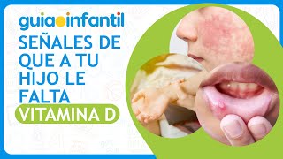 ¿Mi hijo tiene suficiente vitamina D ☀️ Alimentos con vitamina D 🐟 Síntomas de déficit vitamínico [upl. by Pessa862]