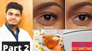 आंखों का पीलापन दूर करने का तरीका  Eye yellowness cause  yellow eye treatment Part 2 [upl. by Sairacaz]