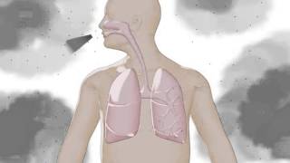 Silicosis lung disease explanatory animation IST [upl. by Adnawaj]