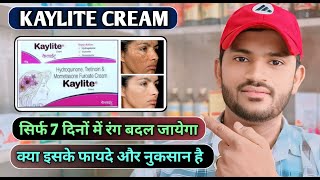 Kaylite cream how to usefull review in hindi जानिए कैलाइट क्रीम के फायदे और नुकसान [upl. by Lucania]