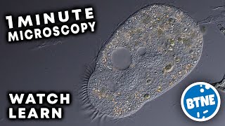 Ciliate Under The Microscope [upl. by Zollie]