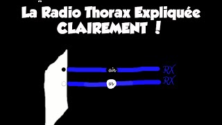 🔴 Dr Astuce  LA RADIO THORAX EXPLIQUÉE CLAIREMENT PARTIE 2  LES VERIFICATIONS [upl. by Marquet430]