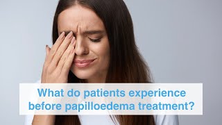 What do patients experience before papilloedema treatment [upl. by Froemming]