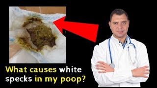 What causes white specks in my poop [upl. by Cynara]