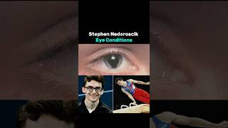 Stephen Nedorosciks Eye Condition  Is it Serious [upl. by Tarr]