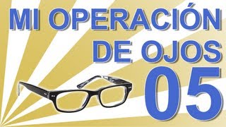 OPERACIÓN DEL SEGUNDO OJO  Experiencia personal operación ojos lentes intraoculares C05 [upl. by Eener]