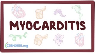 Myocarditis  causes symptoms diagnosis treatment pathology [upl. by Tina987]