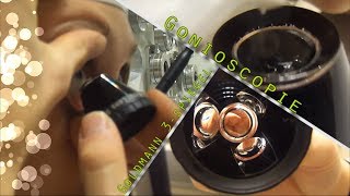 HU Klinische Optometrie  Procedure Gonioscopie Goldmann 3mirror [upl. by Asillem]