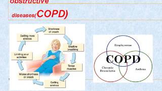 Project on COPD Sign and symptoms Therapy Pathophysiology [upl. by Nuahsyar]