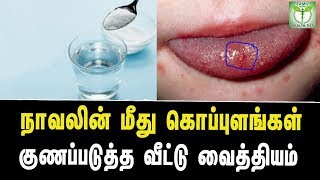 Home Remedies To Cure Blisters On Tongue  Tamil Health Tips [upl. by Nyad332]