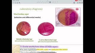 Enterobacteriaceaemicrobiology lab [upl. by Suivatra]