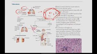 Mycobacteria Tuberculosis Leprosy  Microbiology  14  First Aid USMLE in UrduHindi [upl. by Aprile]