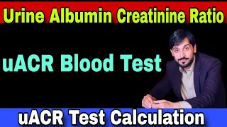 Urine Albumin Creatinine Ratio Test  uACR Test  uACR Test Procedure  uACR Test Calculation [upl. by Ybroc75]