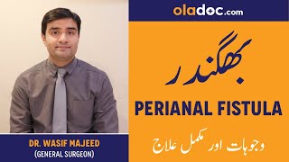 Perianal Fistula Causes Symptoms Treatment Urdu Hindi  Bhagandar Ka Ilaj How To Treat Fistula [upl. by Octavla]