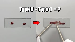 What Happens When Two Different Blood Types are Mixed Together [upl. by Litch]