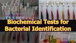 BIOCHEMICAL TESTS FOR BACTERIAL IDENTIFICATION [upl. by Lothar]