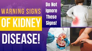 quot6 Silent Signs Your Kidneys Are in Danger Don’t Ignore These Warning Symptoms [upl. by Wahl]