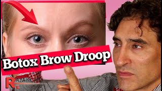 BOTOX BROW DROOP  Brow Tutorial [upl. by Ymrej]