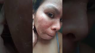 Maxi peel review no3 part3 [upl. by Adnana]