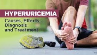 hyperuricemia and its Treatment Gout hyperuricaemia treatment drbadarkhan kneeepain jonpain [upl. by Enialem]