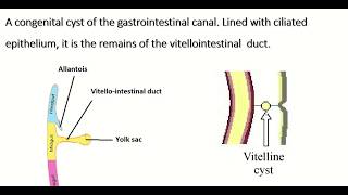 Embryology of vitellointestinal duct  formation fate amp congenital anomalies [upl. by Laraine589]