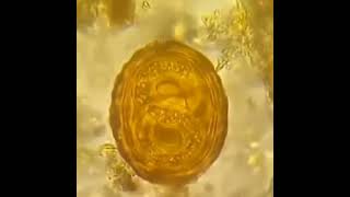 🔬Huevos embrionado de Ascaris lumbricoides bajo el microscopio  Parasitología [upl. by Sibley877]